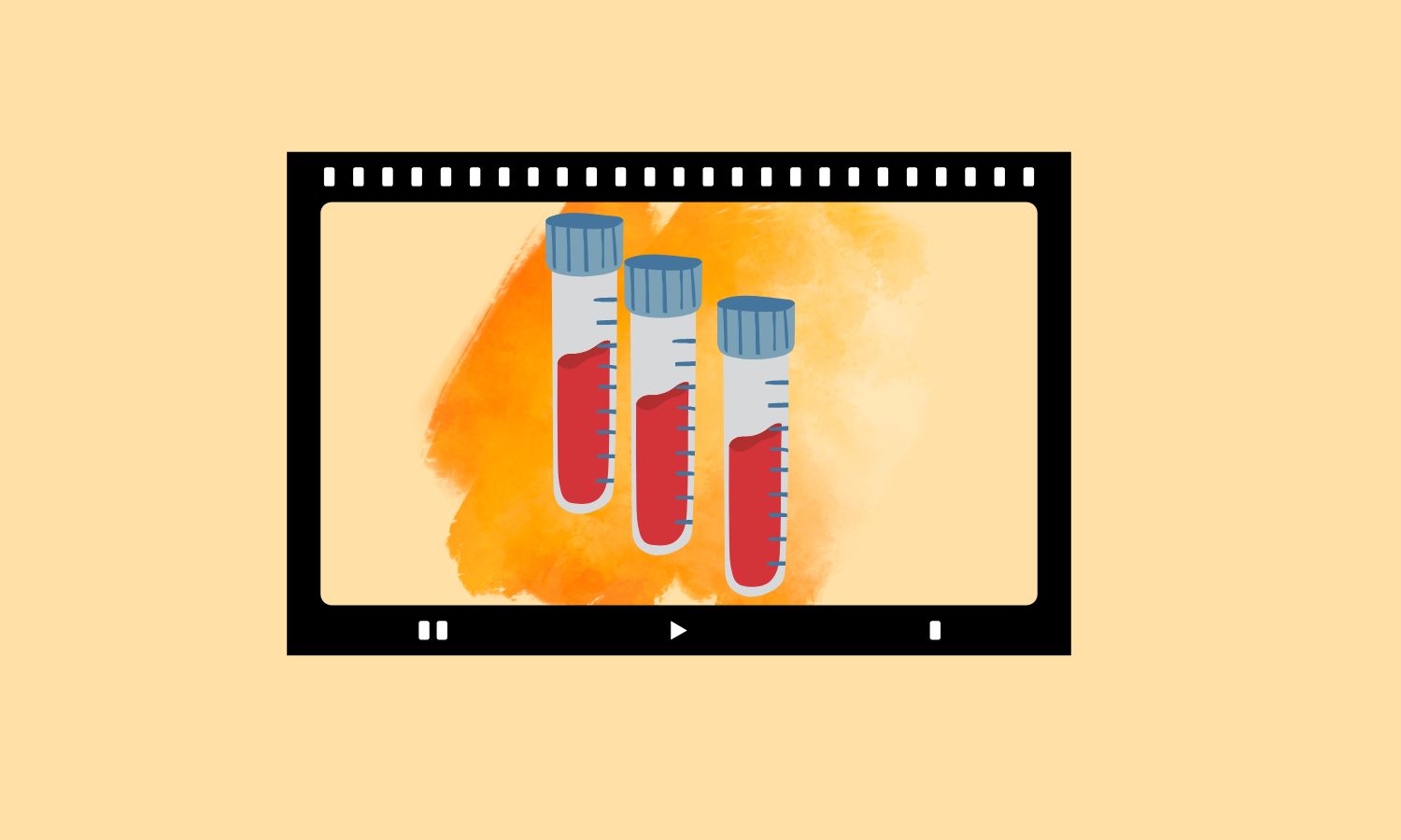Análisis de sangre para predecir el alzhéimer: comienza una nueva era en la prevención