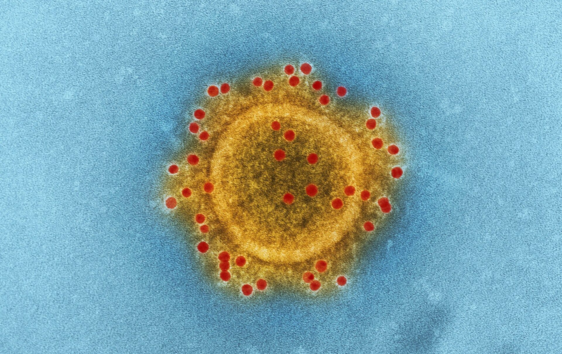 Un planeta de virus: el descubrimiento de la virosfera