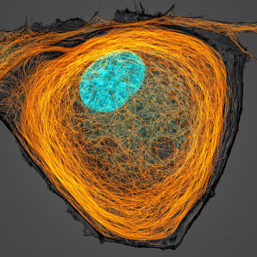 Microtúbulos (naranja) dentro de una célula. El núcleo aparece en cian