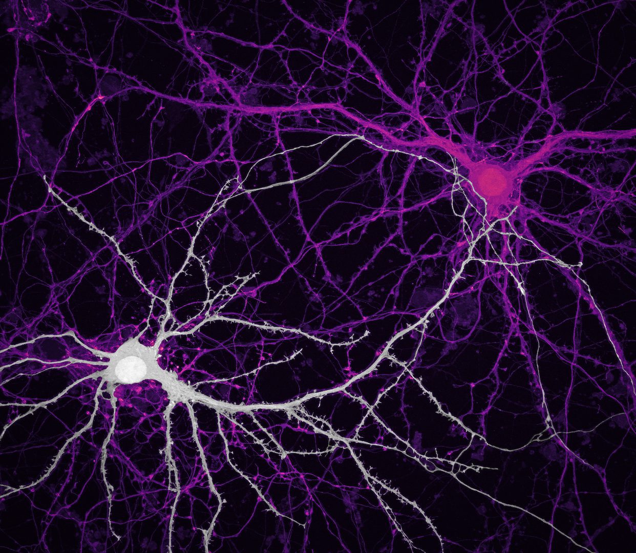 Conexiones entre las neuronas hipocampales (células cerebrales)