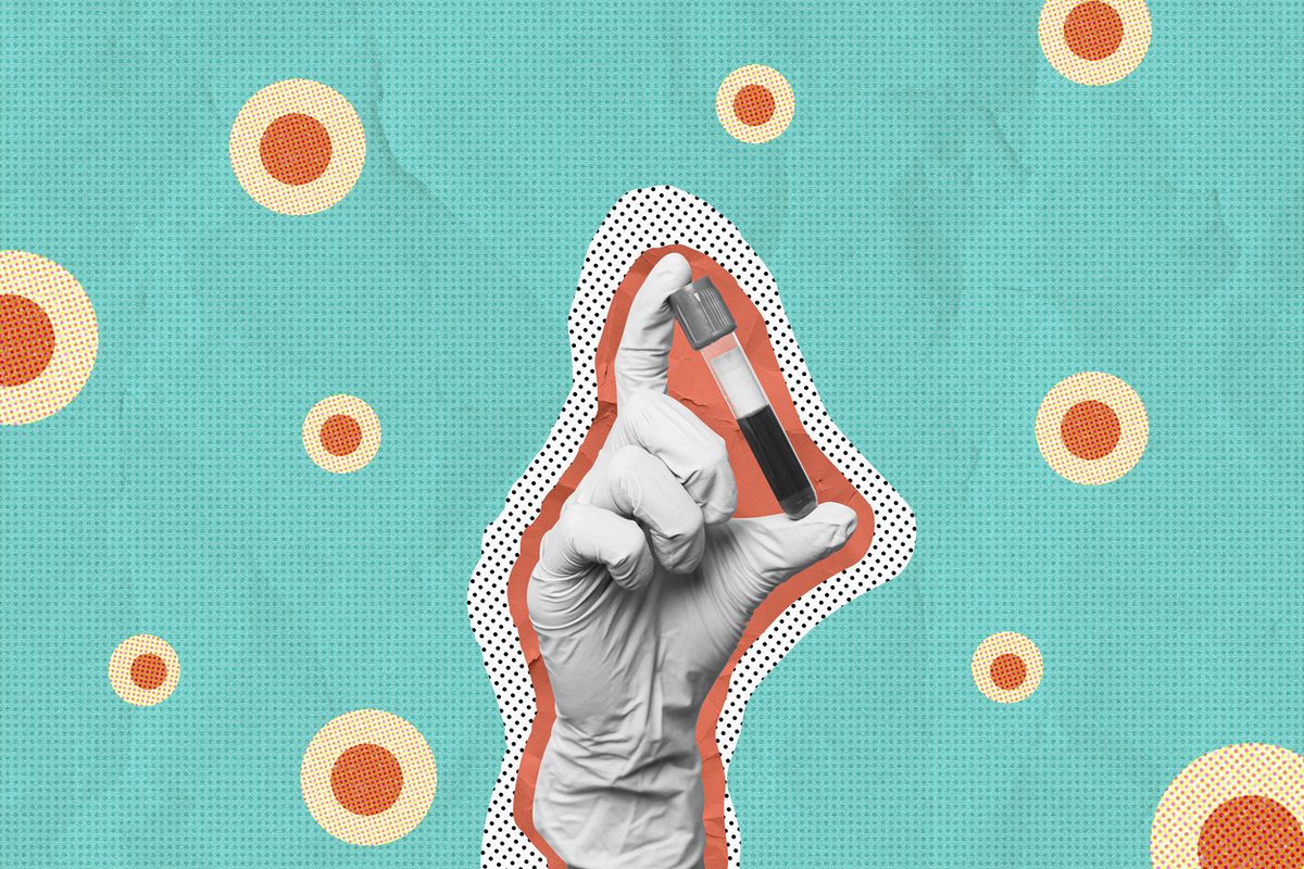 Del primer caso a la primera vacuna: un recorrido por la historia del VIH