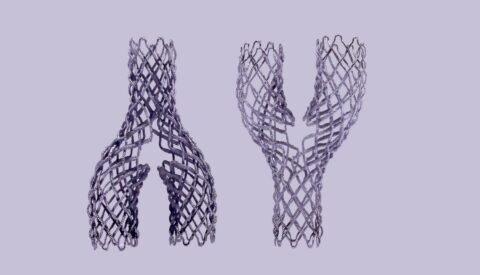 La tecnología de implantes vasculares Nitibraid gana el James Dyson Award 2026