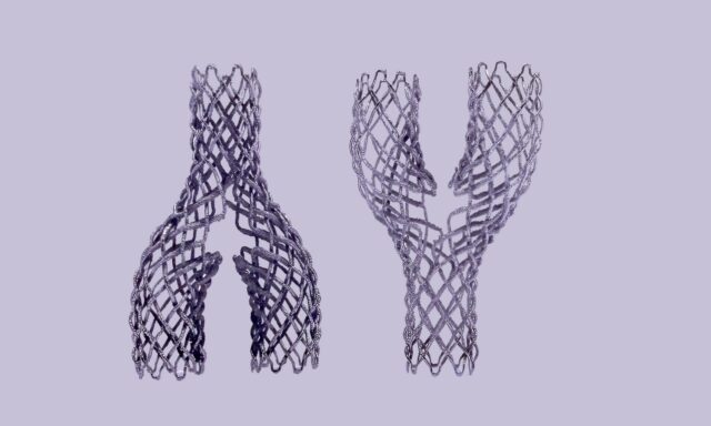 La tecnología de implantes vasculares Nitibraid gana el James Dyson Award 2026